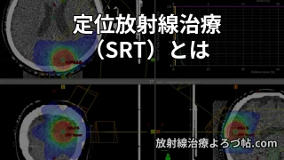 SRTとは？定位放射線治療の仕組み・適応・SBRTとの違いを専門医が解説