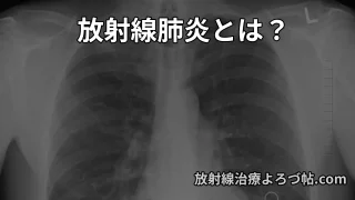 Thumbnail of post image 140